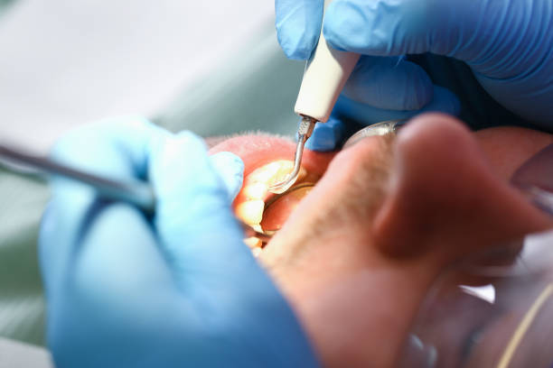Best Broken Tooth Emergency  in Lyons, KS