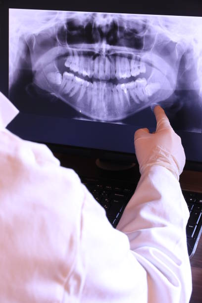 Best Knocked-Out Tooth Emergency  in Lyons, KS