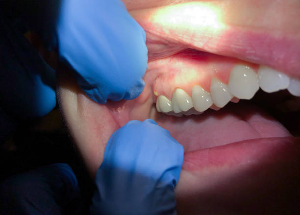 Tooth Infection Emergency Dentist in KS